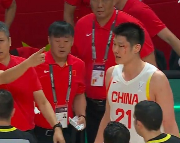 胡金秋：眼角没事&这都是小事 只要能赢球&付出全部都没关系